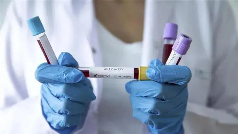 Occupied Abkhazia confirms first case of coronavirus