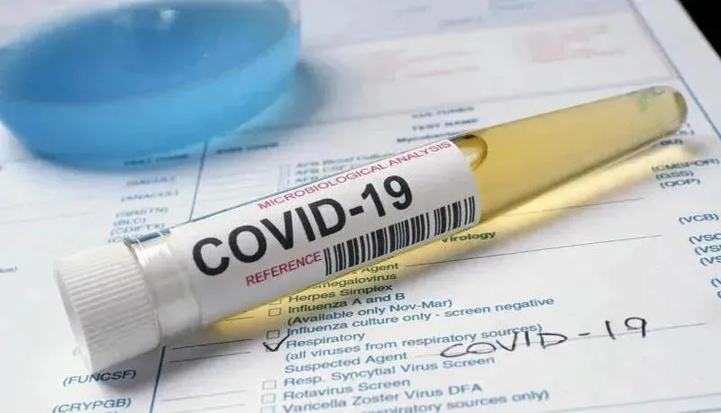 12 more people test positive for coronavirus in Tskhinvali