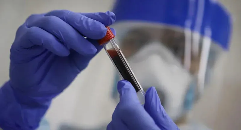 4 more people test positive for coronavirus in Tskhinvali