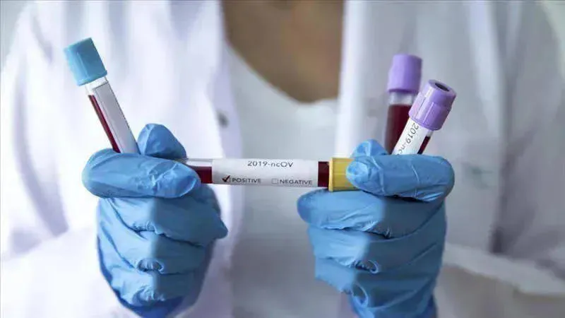 One person dies of coronavirus in occupied Abkhazia